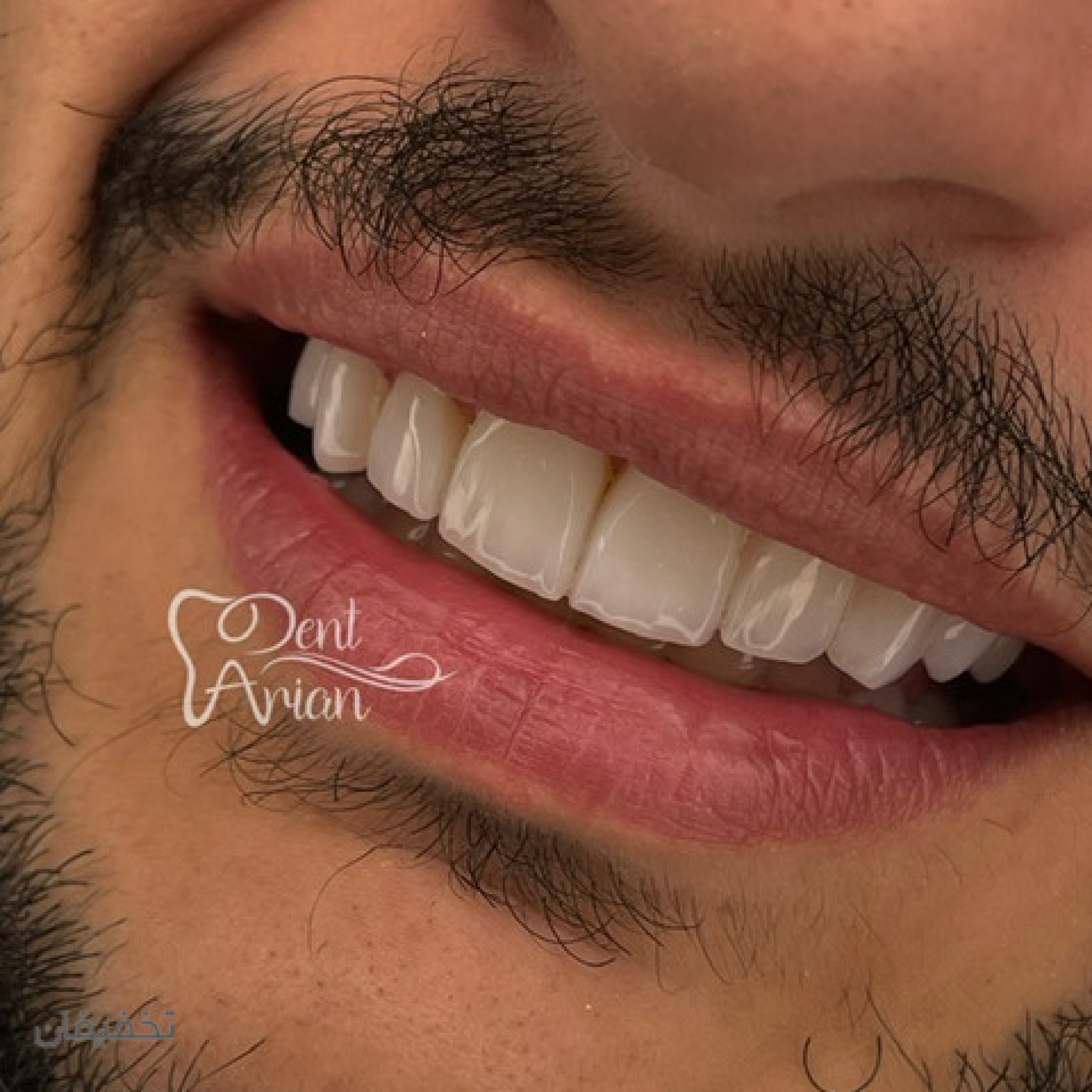 مركز دندانپزشكى دنت آرين