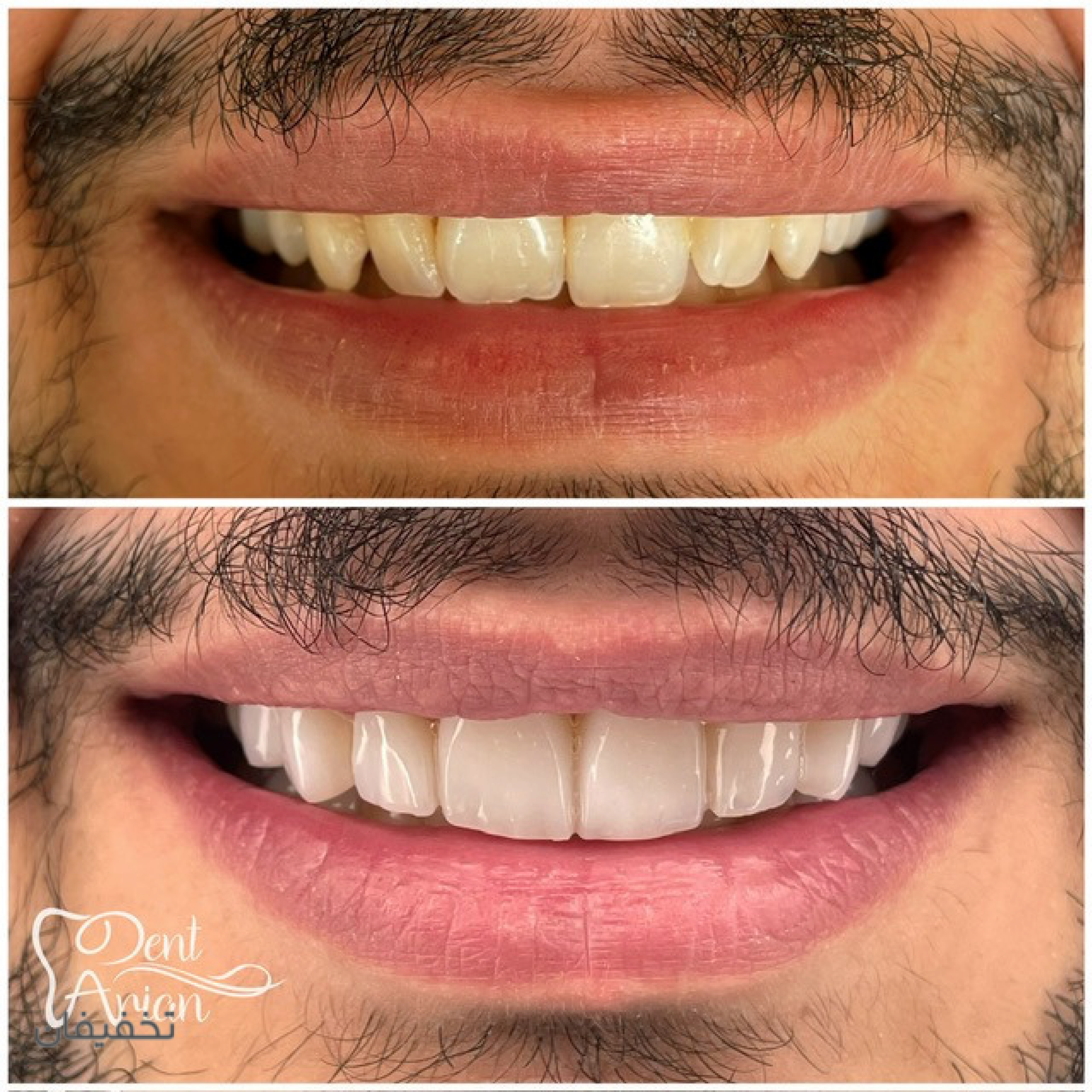 مركز دندانپزشكى دنت آرين