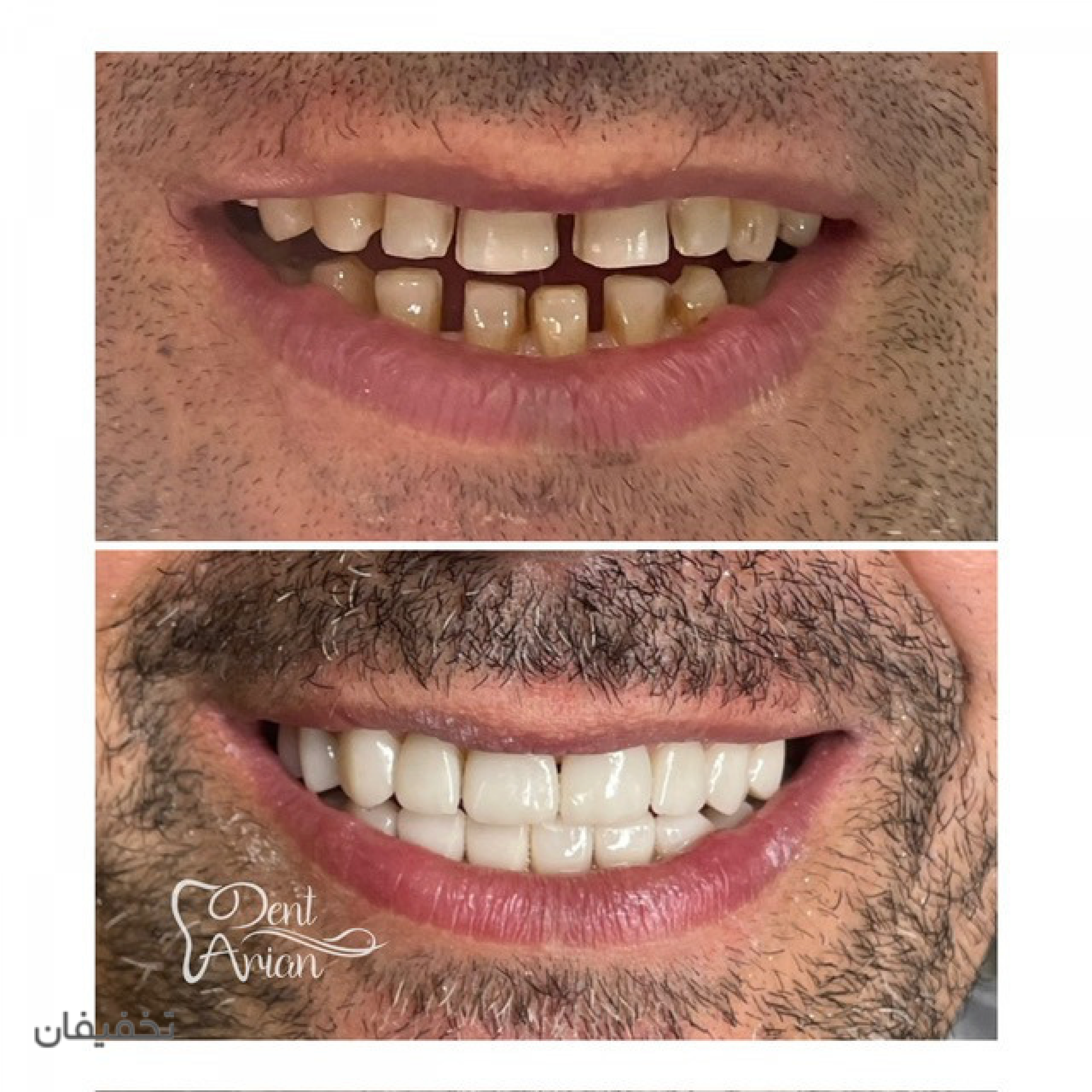 مركز دندانپزشكى دنت آرين
