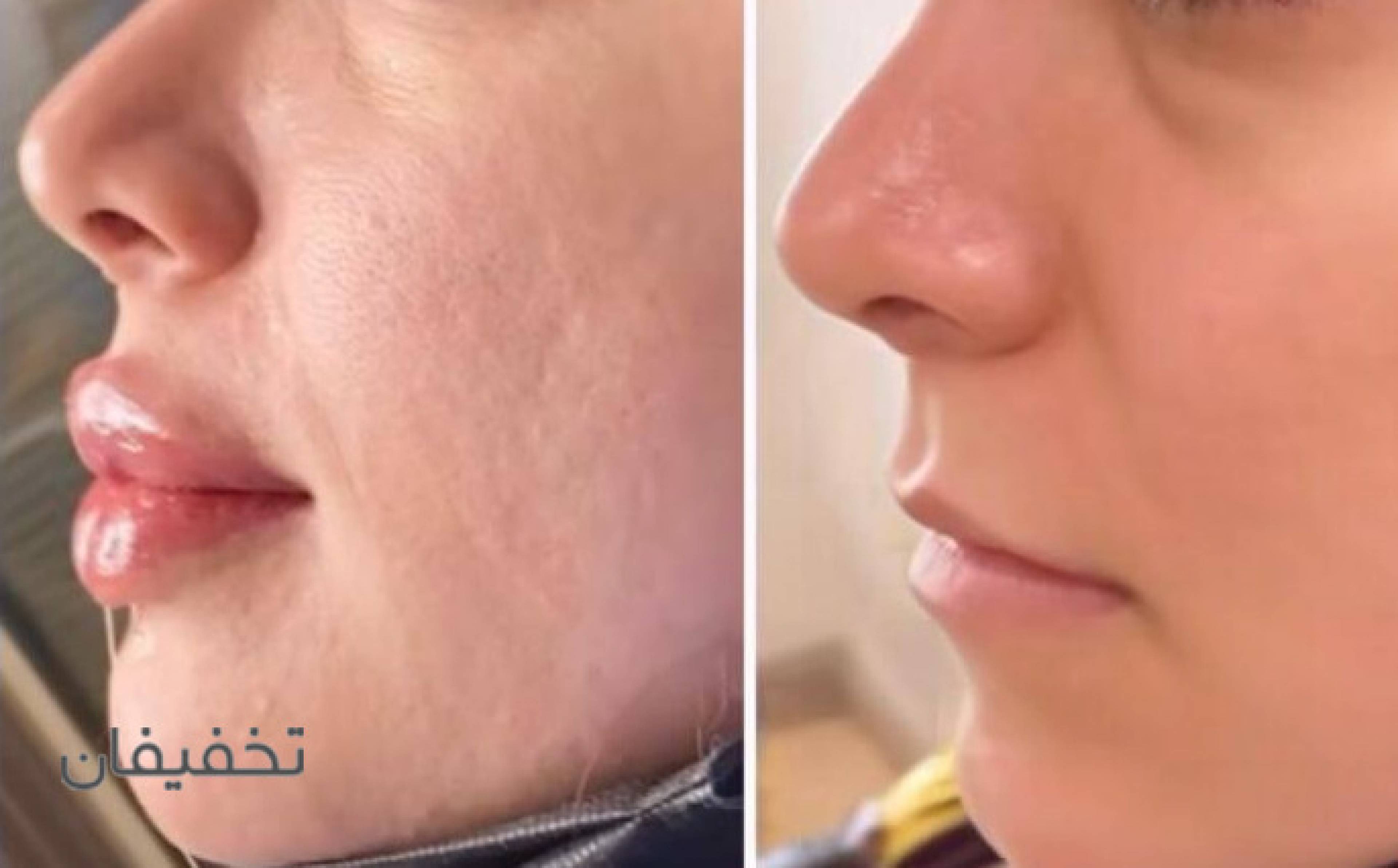 مطب زیبایی دکتر حسین محمودآبادی
