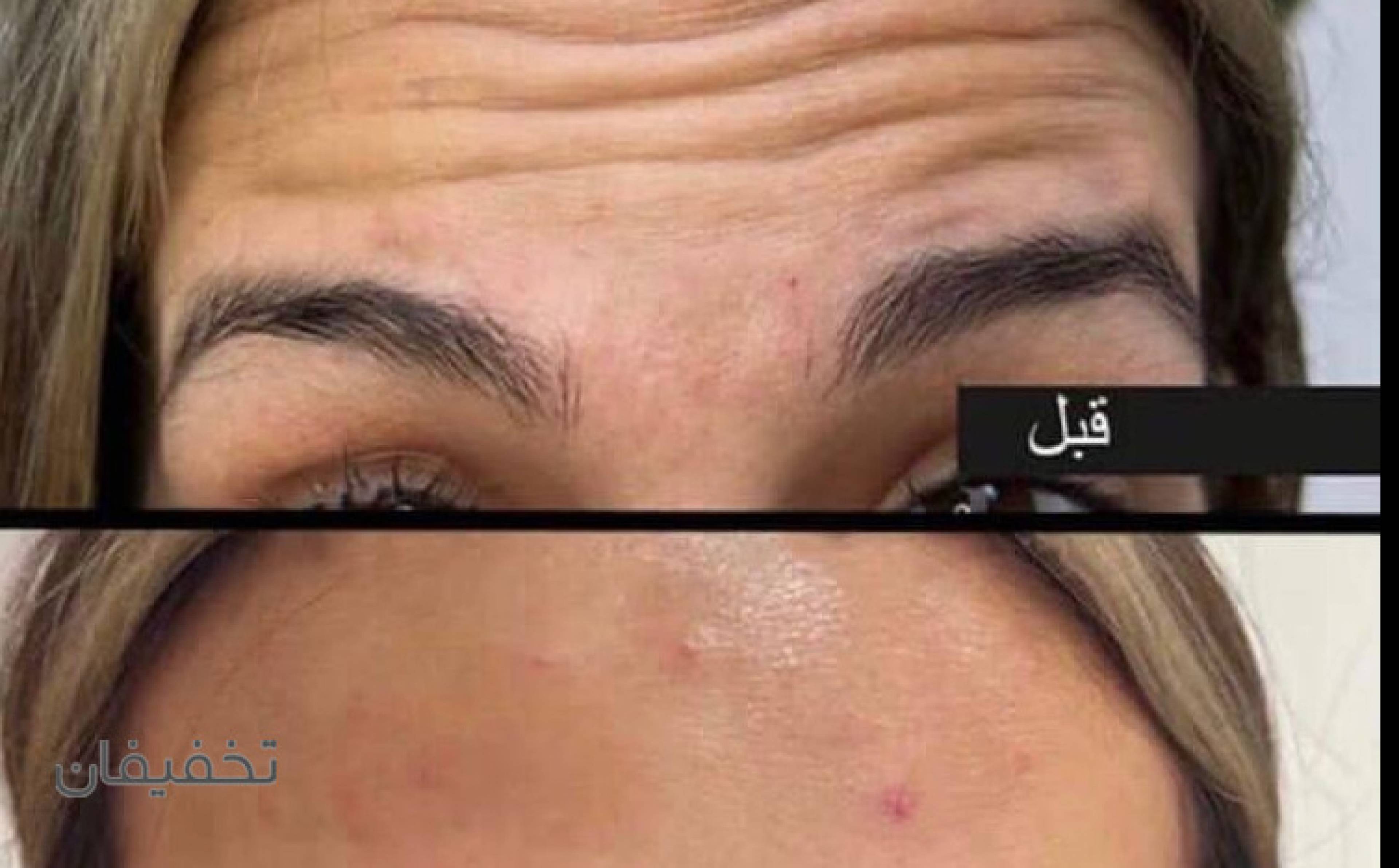 مطب زیبایی دکتر حسین محمودآبادی