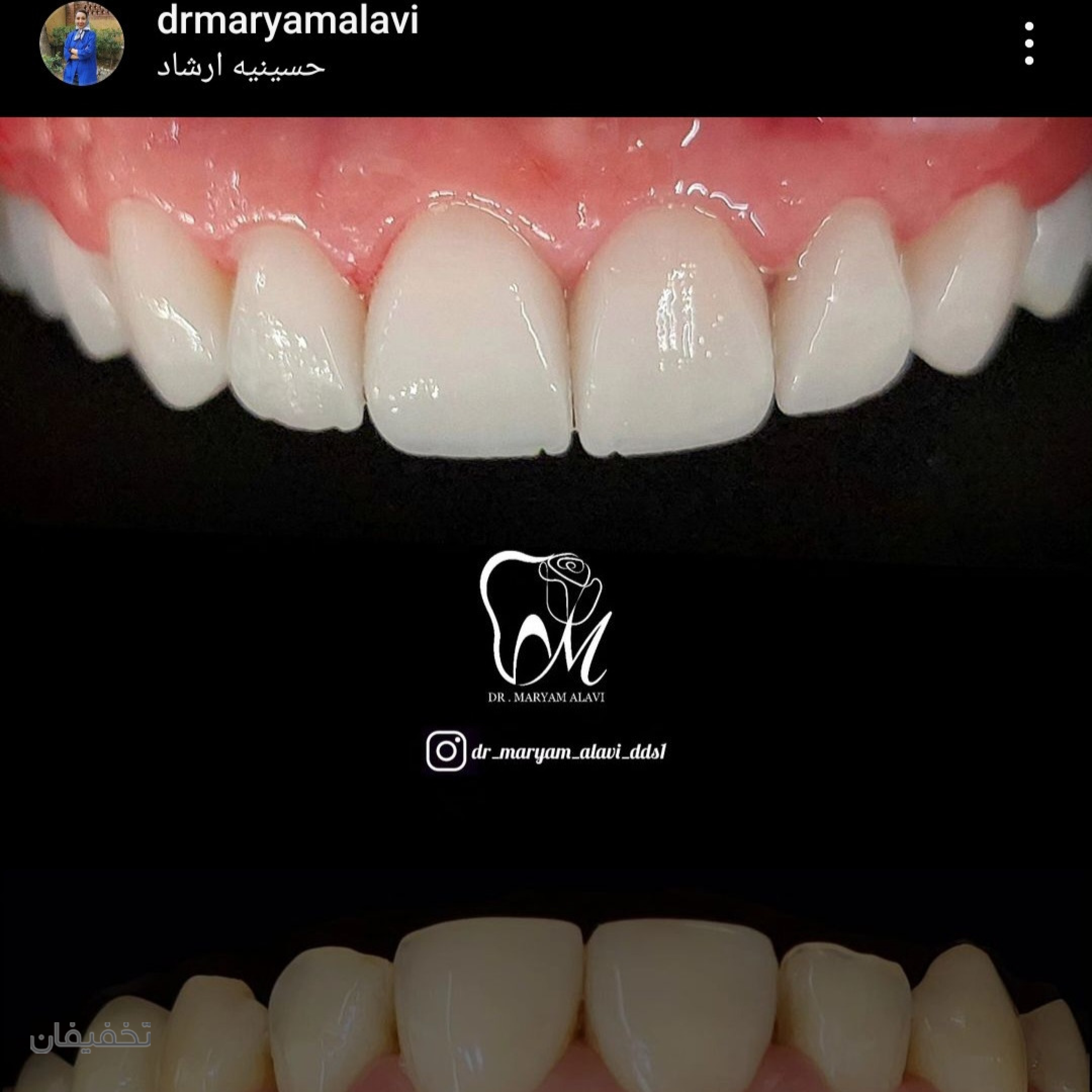 مطب دندانپزشکی دکتر مریم علوی
