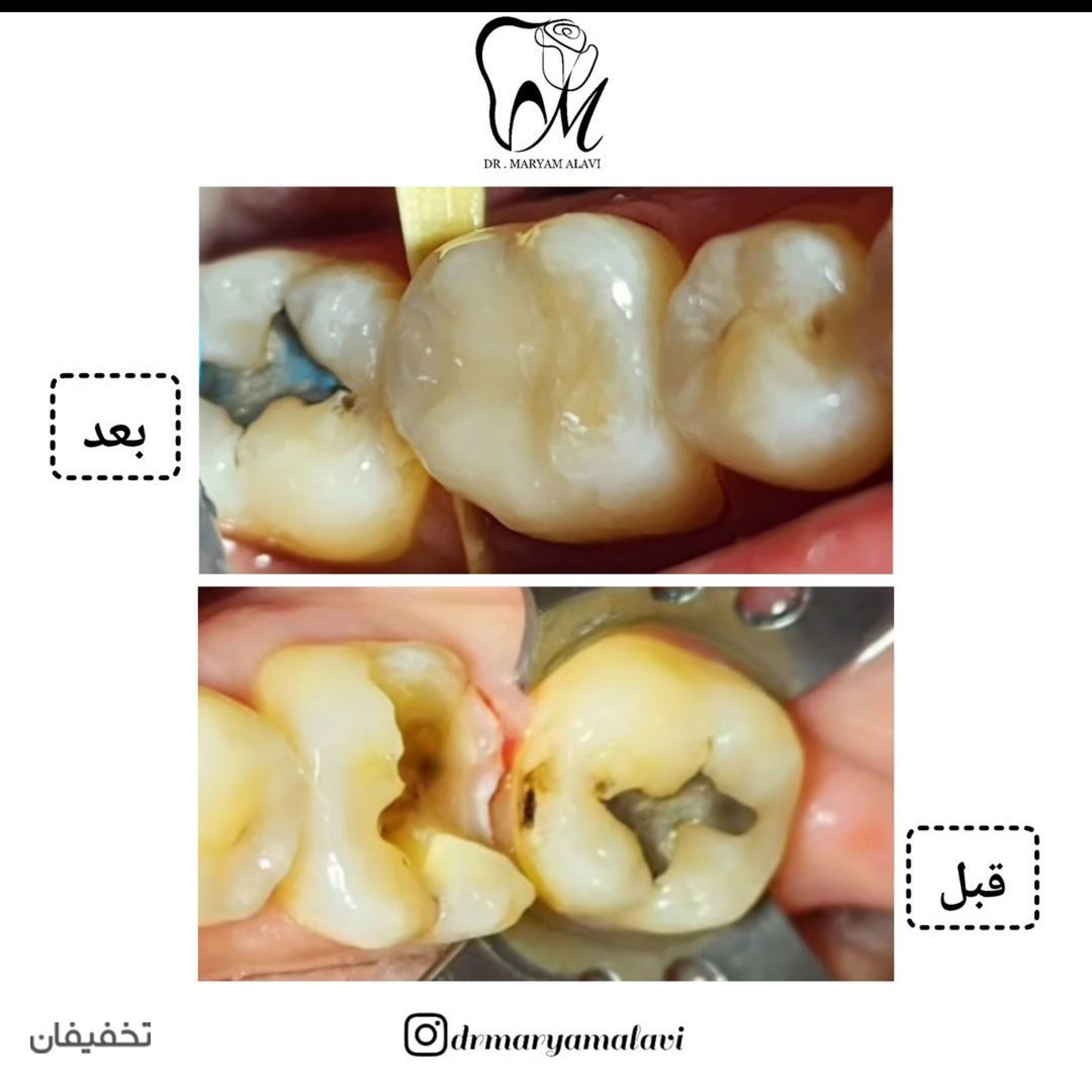 مطب دندانپزشکی دکتر مریم علوی
