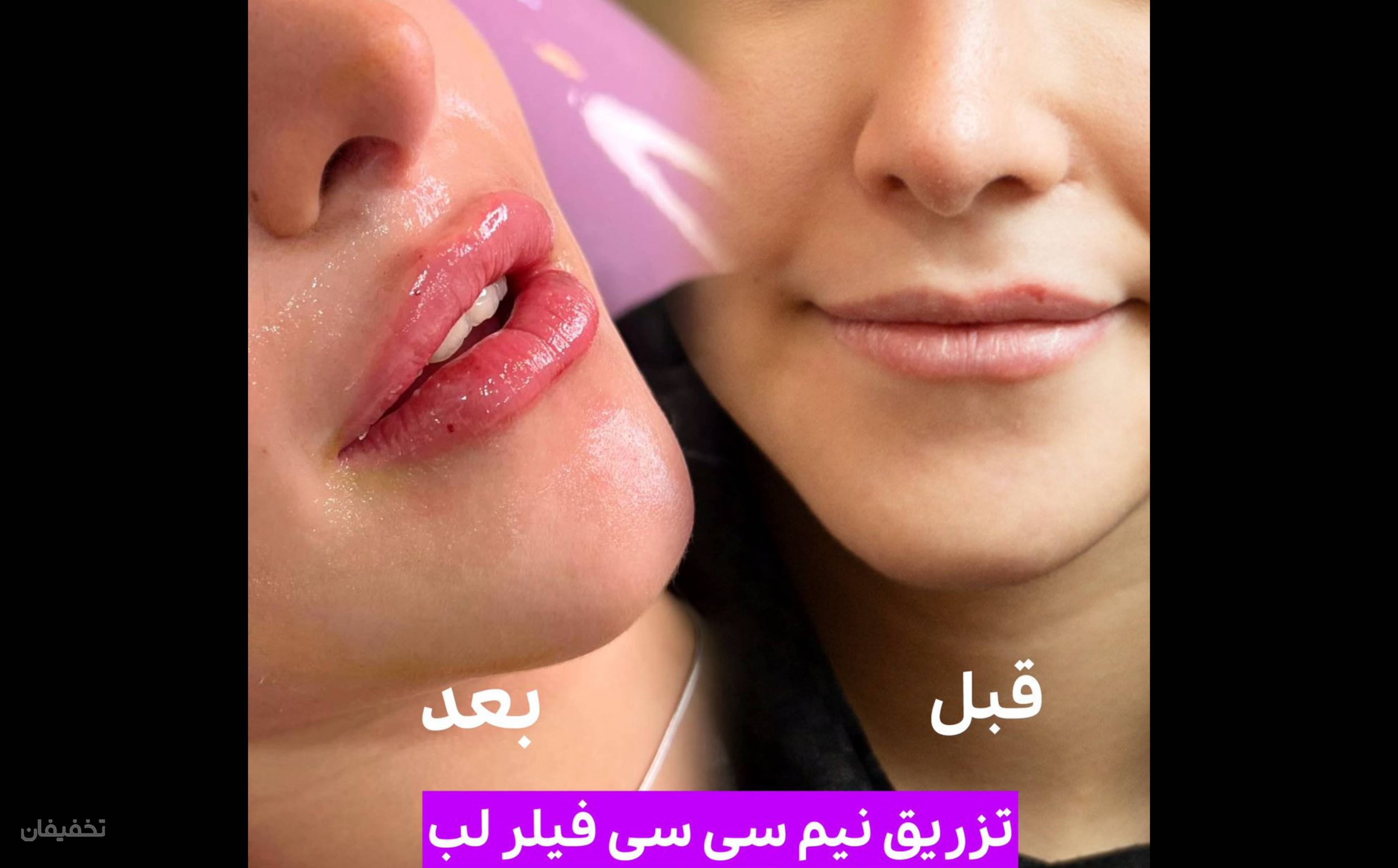 کلینیک زیبایی نازرخ