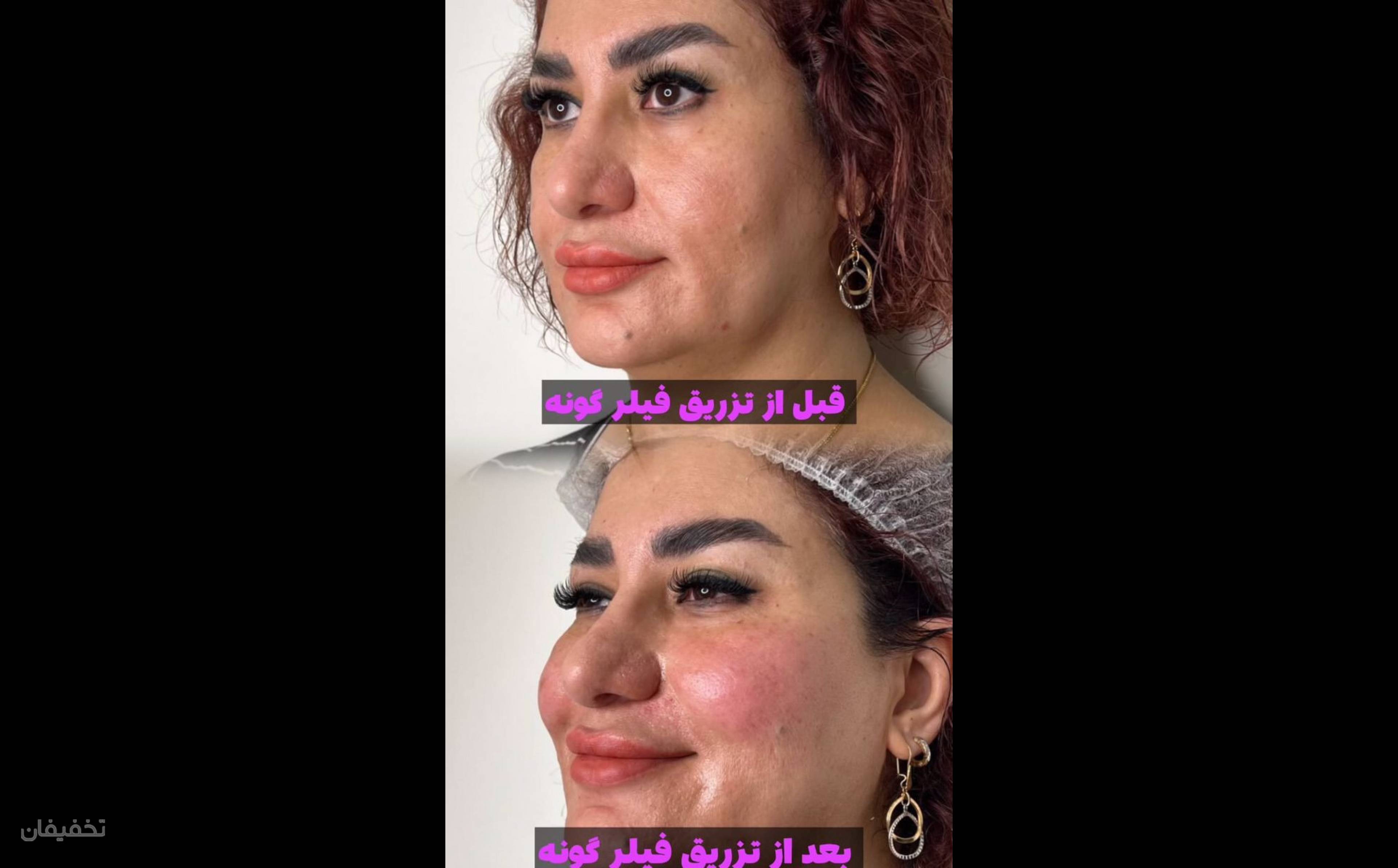 کلینیک زیبایی نازرخ