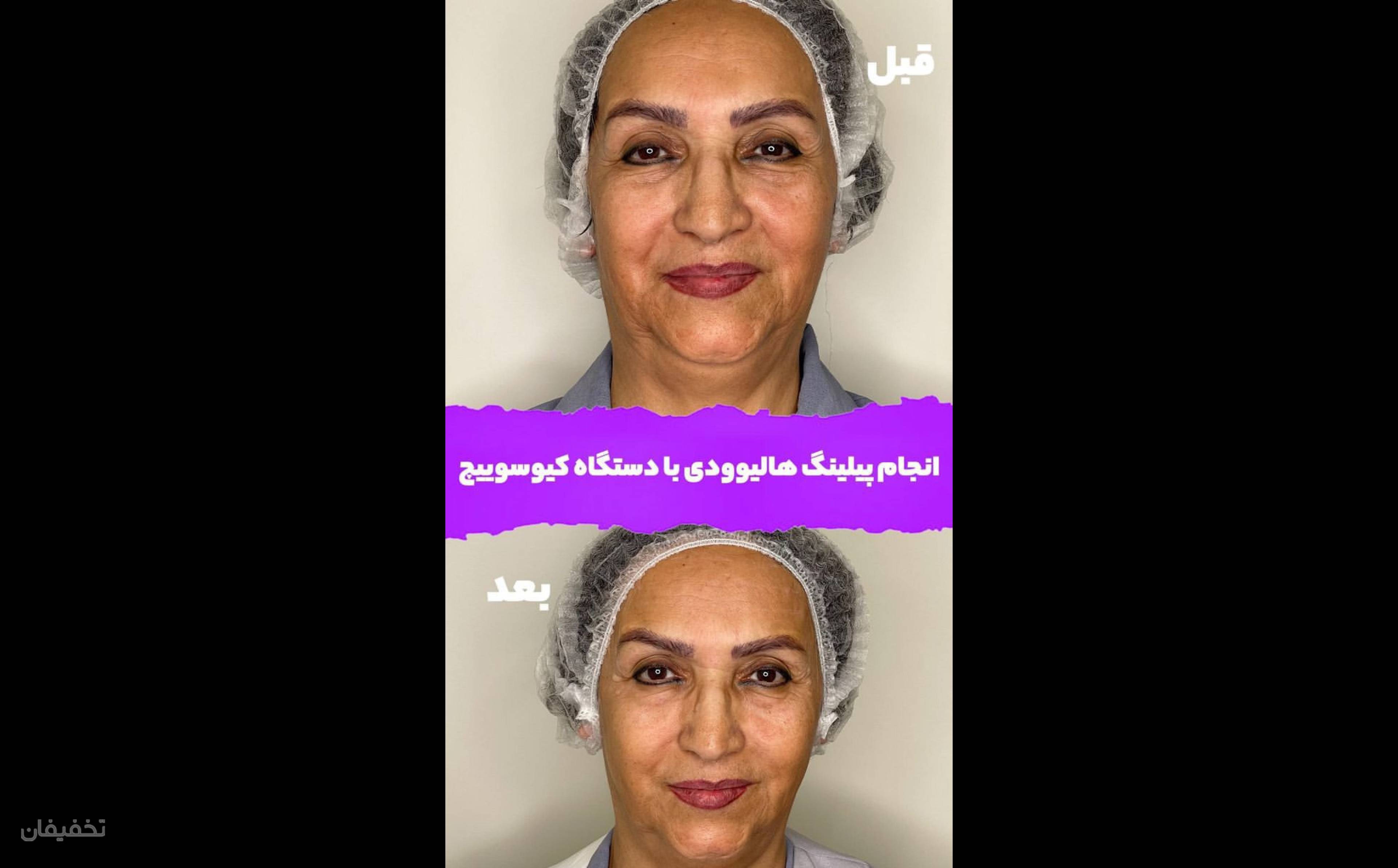 کلینیک زیبایی نازرخ