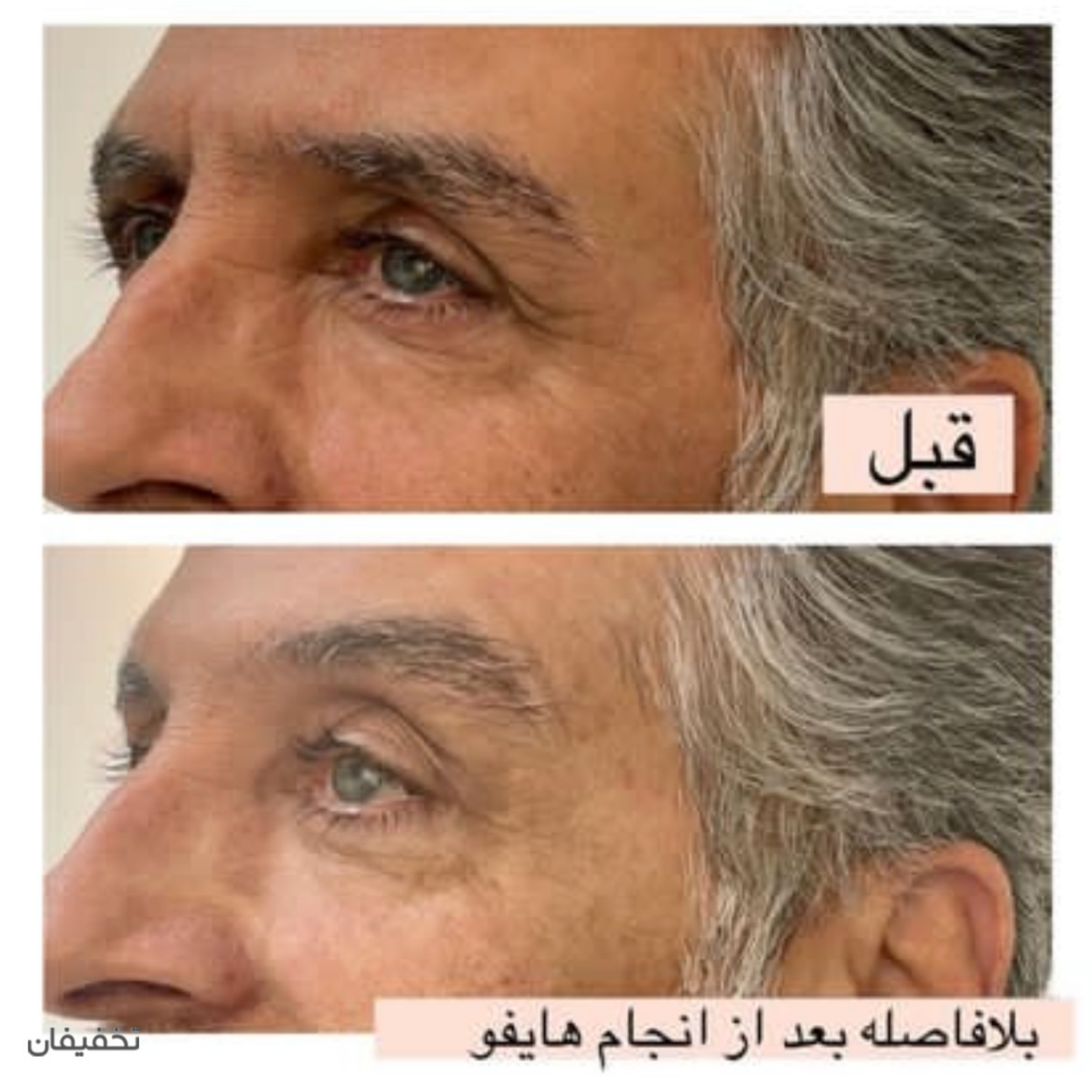 مرکز زیبایی مانترا