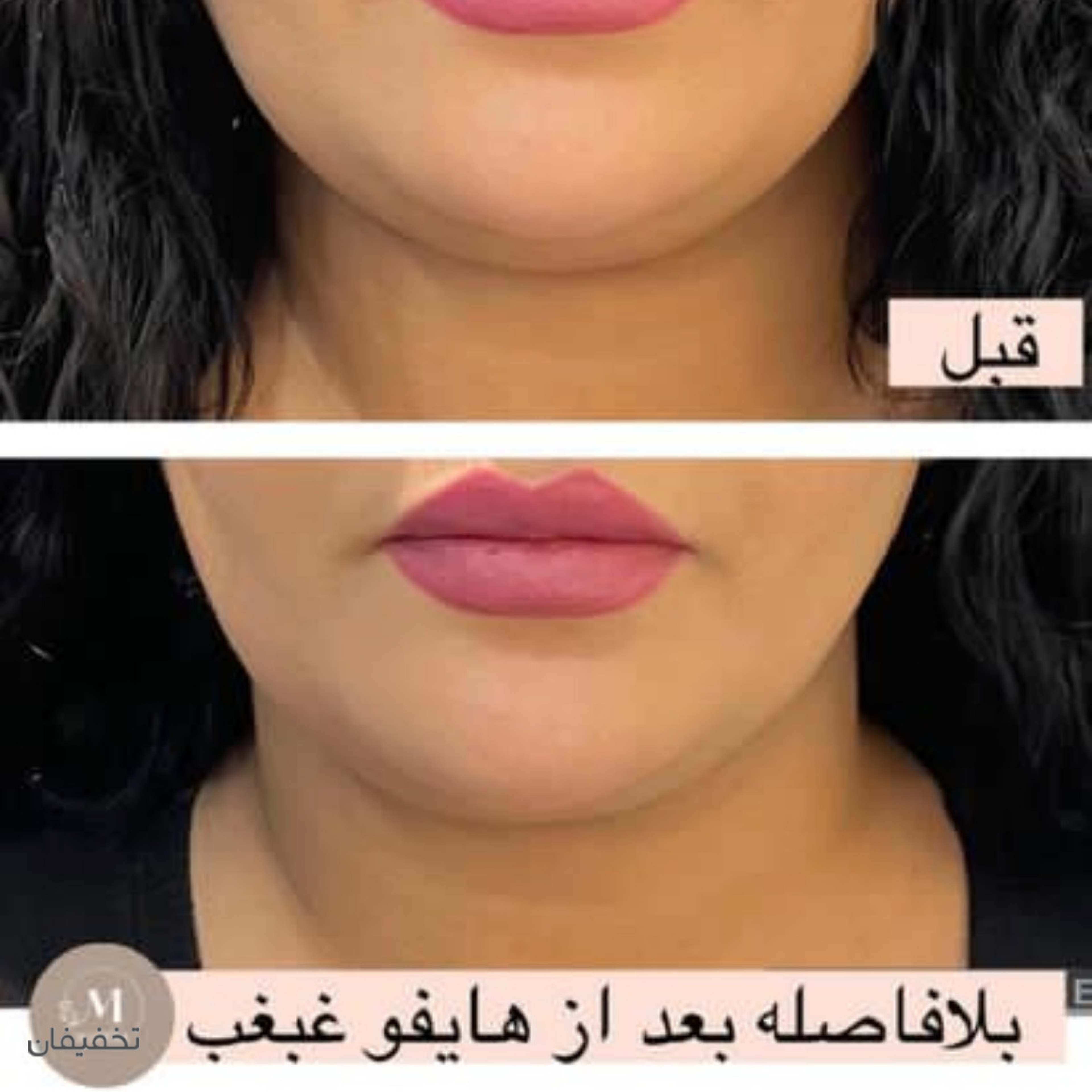 مرکز زیبایی مانترا